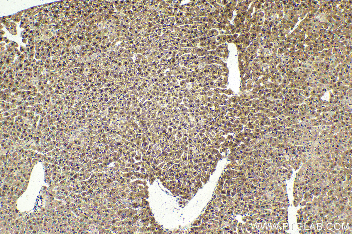 Immunohistochemical analysis of paraffin-embedded mouse liver tissue slide using KHC2143 (SMC2 IHC Kit).