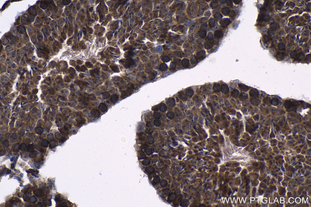Immunohistochemical analysis of paraffin-embedded mouse testis tissue slide using KHC1221 (SMC4 IHC Kit).