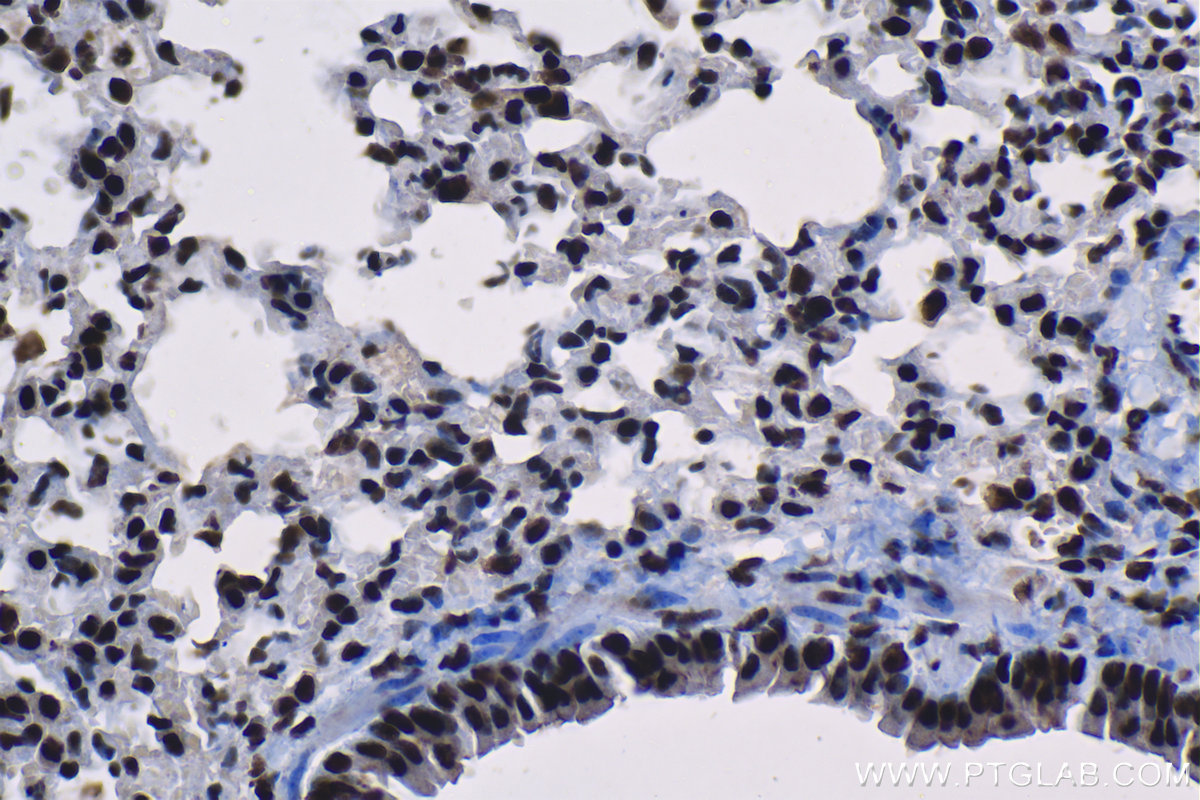 Immunohistochemical analysis of paraffin-embedded mouse lung tissue slide using KHC1306 (SNRPA1 IHC Kit).