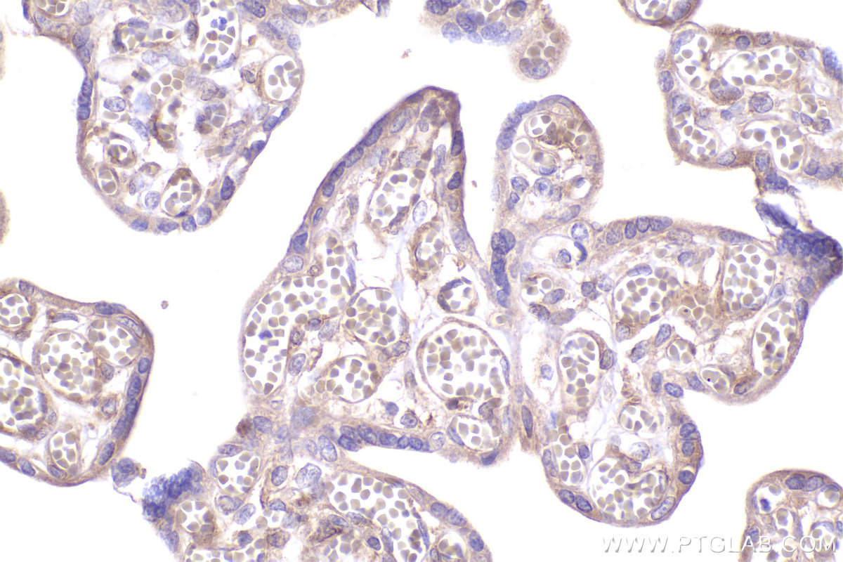 Immunohistochemical analysis of paraffin-embedded human placenta tissue slide using KHC2400 (SOS1 IHC Kit).