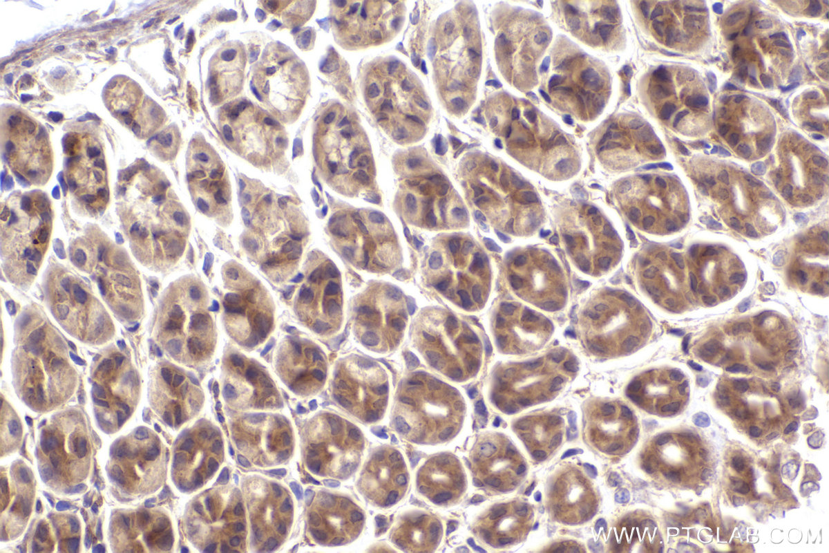 Immunohistochemical analysis of paraffin-embedded mouse stomach tissue slide using KHC2400 (SOS1 IHC Kit).