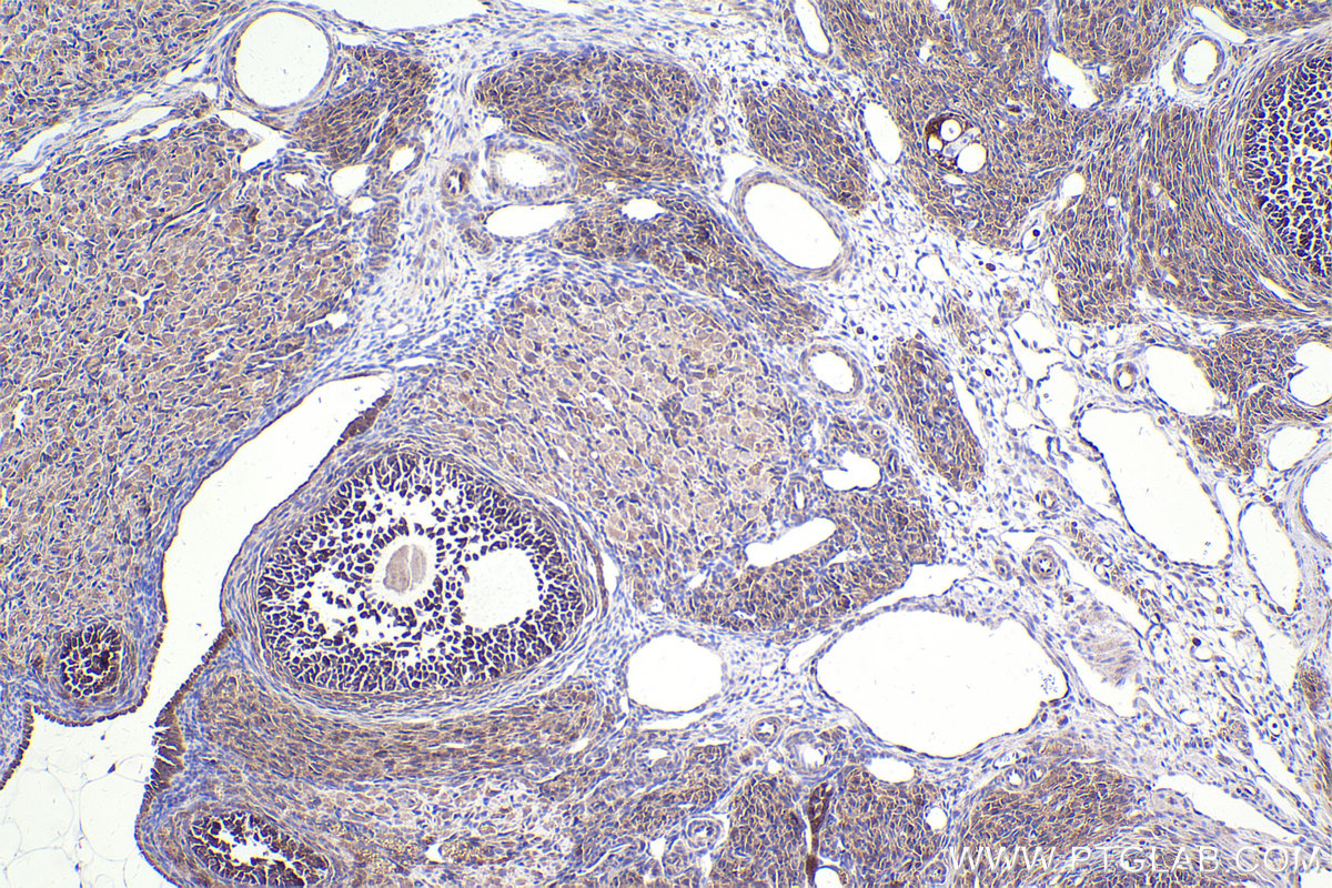 Immunohistochemical analysis of paraffin-embedded rat ovary tissue slide using KHC2400 (SOS1 IHC Kit).