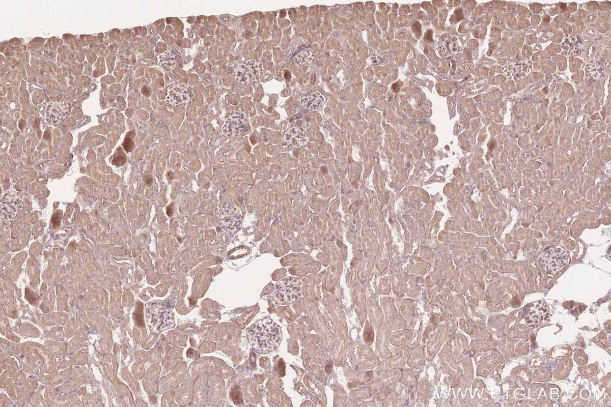 Immunohistochemical analysis of paraffin-embedded mouse kidney tissue slide using KHC2574 (SPECC1L/CYTSA IHC Kit).