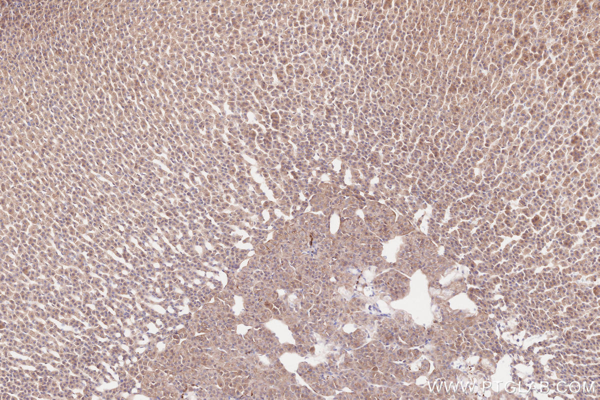 Immunohistochemical analysis of paraffin-embedded rat adrenal gland tissue slide using KHC2574 (SPECC1L/CYTSA IHC Kit).