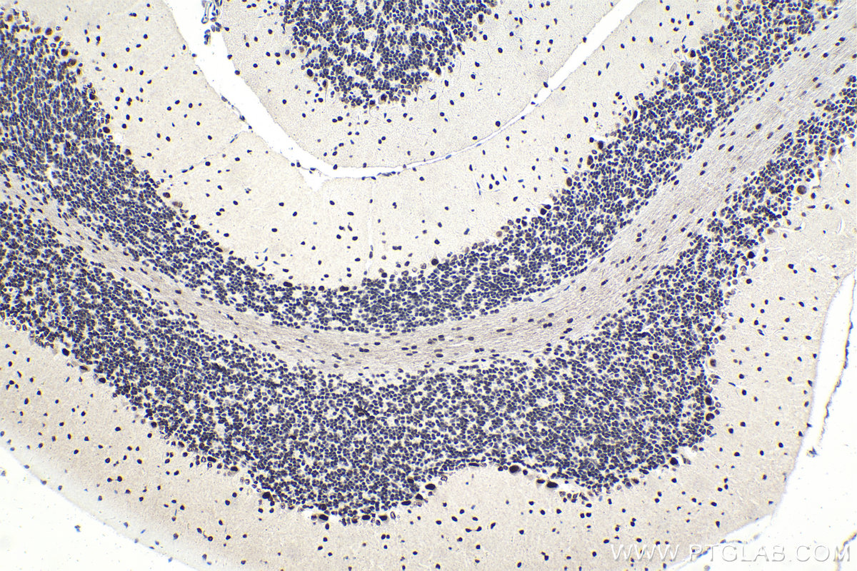 Immunohistochemical analysis of paraffin-embedded mouse cerebellum tissue slide using KHC1824 (SRRM1 IHC Kit).