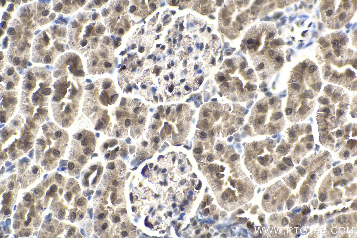 Immunohistochemical analysis of paraffin-embedded rat kidney tissue slide using KHC1952 (SSU72 IHC Kit).