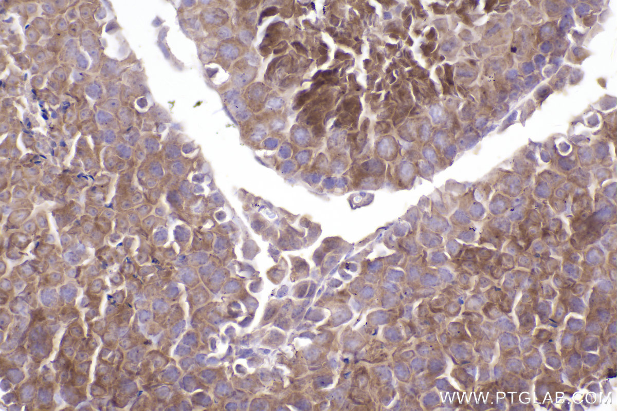 Immunohistochemical analysis of paraffin-embedded mouse testis tissue slide using KHC2489 (STIL IHC Kit).