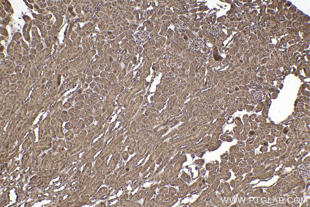 Immunohistochemical analysis of paraffin-embedded mouse kidney tissue slide using KHC2237 (STIP1 IHC Kit).