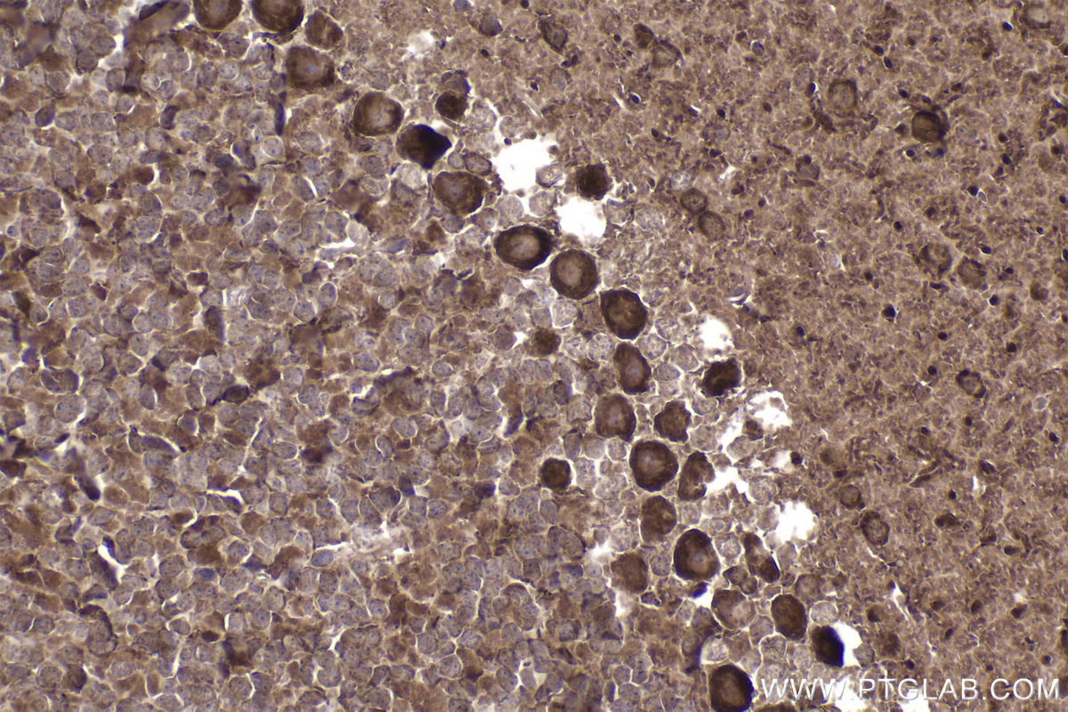 Immunohistochemical analysis of paraffin-embedded mouse cerebellum tissue slide using KHC2237 (STIP1 IHC Kit).