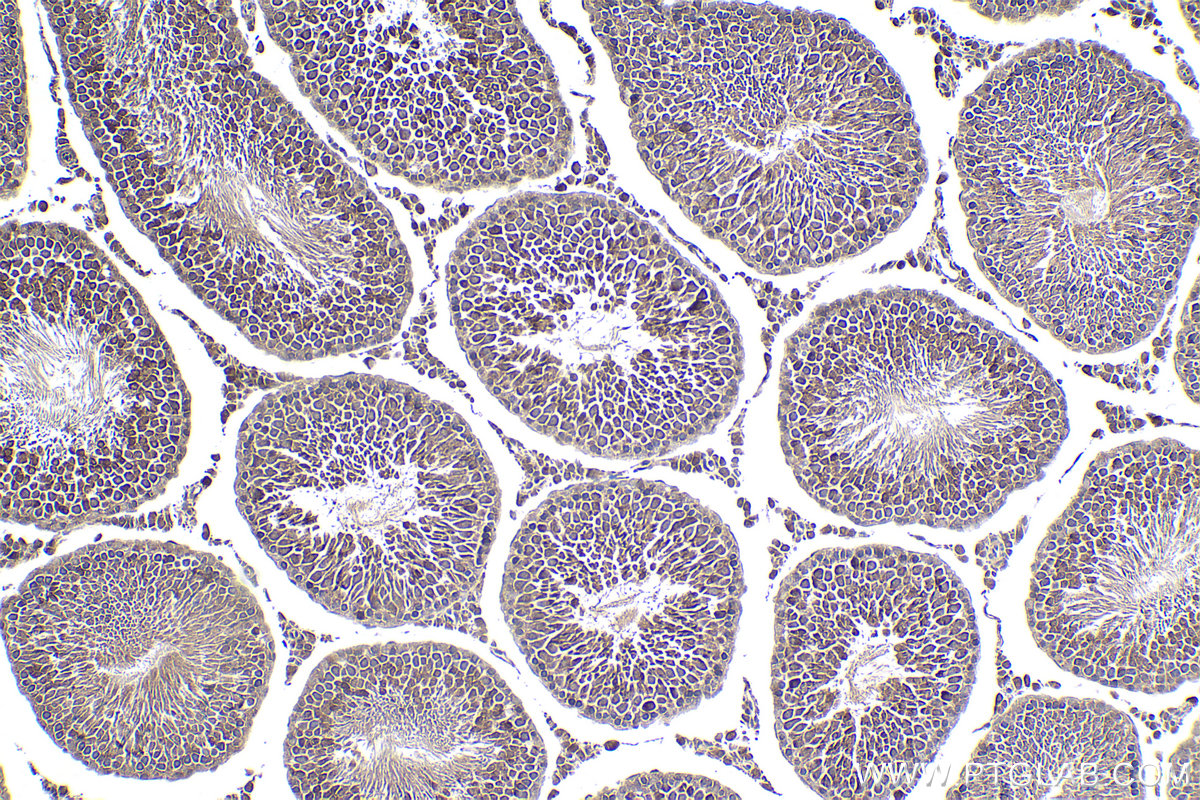 Immunohistochemical analysis of paraffin-embedded rat testis tissue slide using KHC1962 (STK36 IHC Kit).