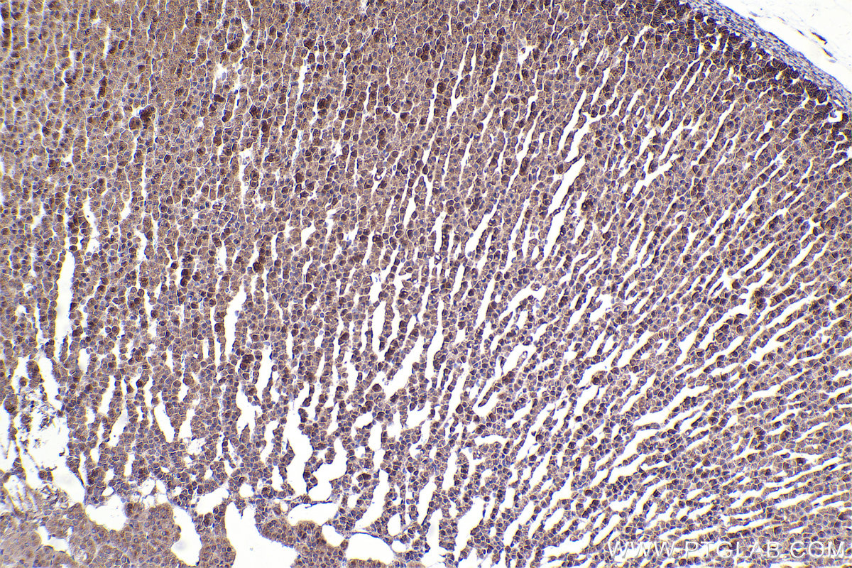 Immunohistochemical analysis of paraffin-embedded rat adrenal gland tissue slide using KHC2415 (STRN3 IHC Kit).