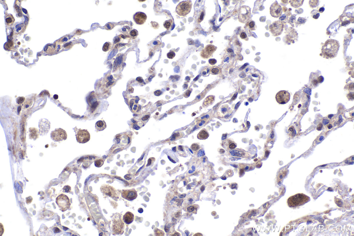 Immunohistochemical analysis of paraffin-embedded human lung tissue slide using KHC2003 (STUB1 IHC Kit).