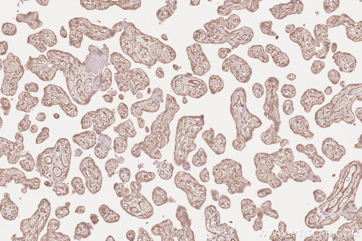 Immunohistochemical analysis of paraffin-embedded human placenta tissue slide using KHC2608 (STXBP4 IHC Kit).