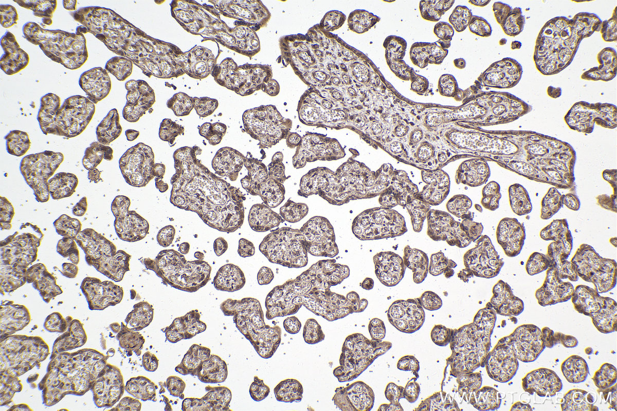 Immunohistochemical analysis of paraffin-embedded human placenta tissue slide using KHC2001 (SUFU IHC Kit).