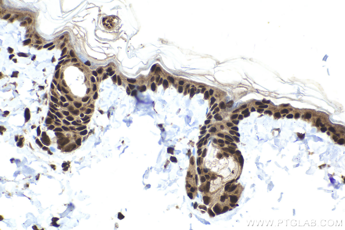 Immunohistochemical analysis of paraffin-embedded rat skin tissue slide using KHC2026 (SUPT16H IHC Kit).