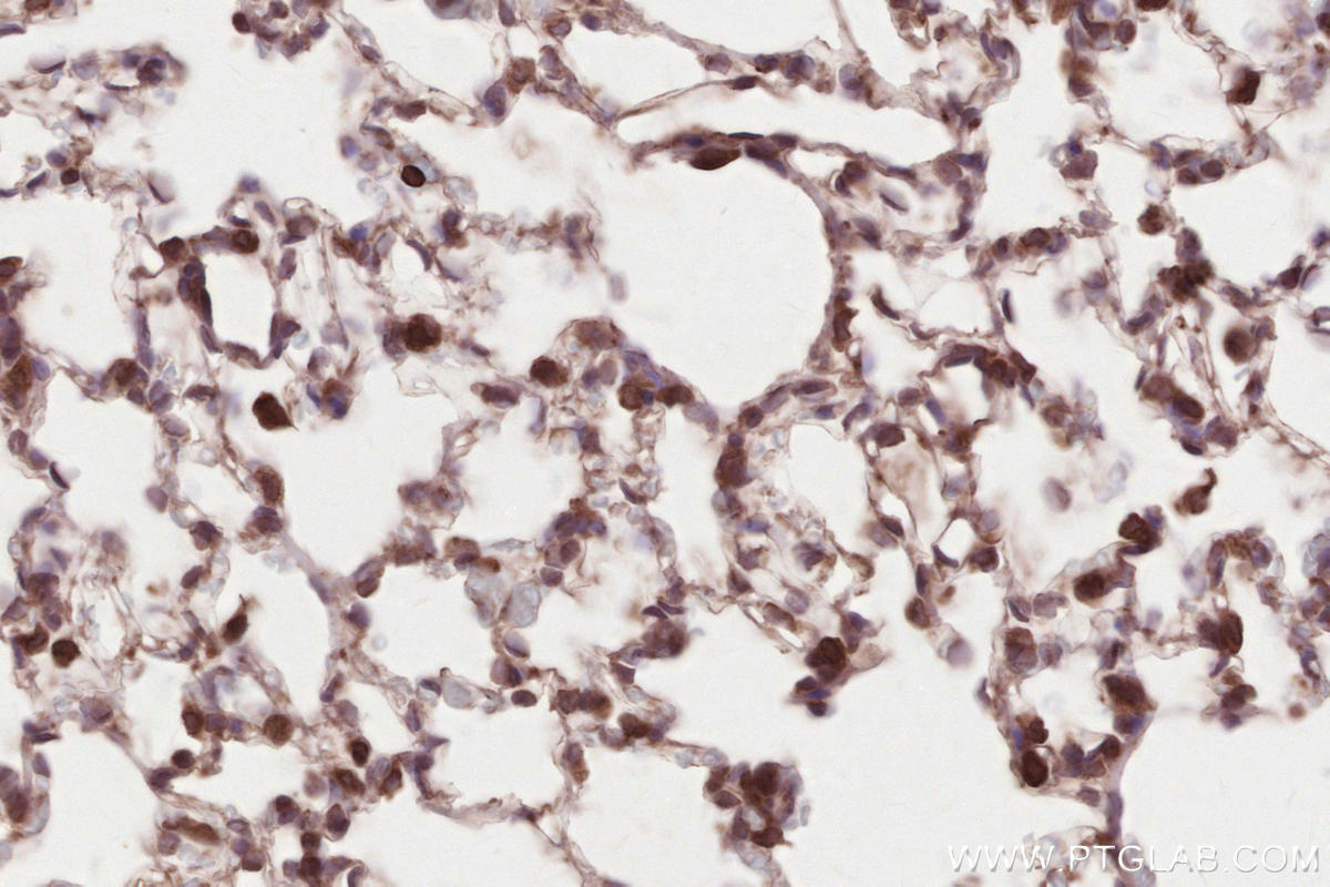 Immunohistochemical analysis of paraffin-embedded rat lung tissue slide using KHC2633 (SYVN1/HRD1 IHC Kit).