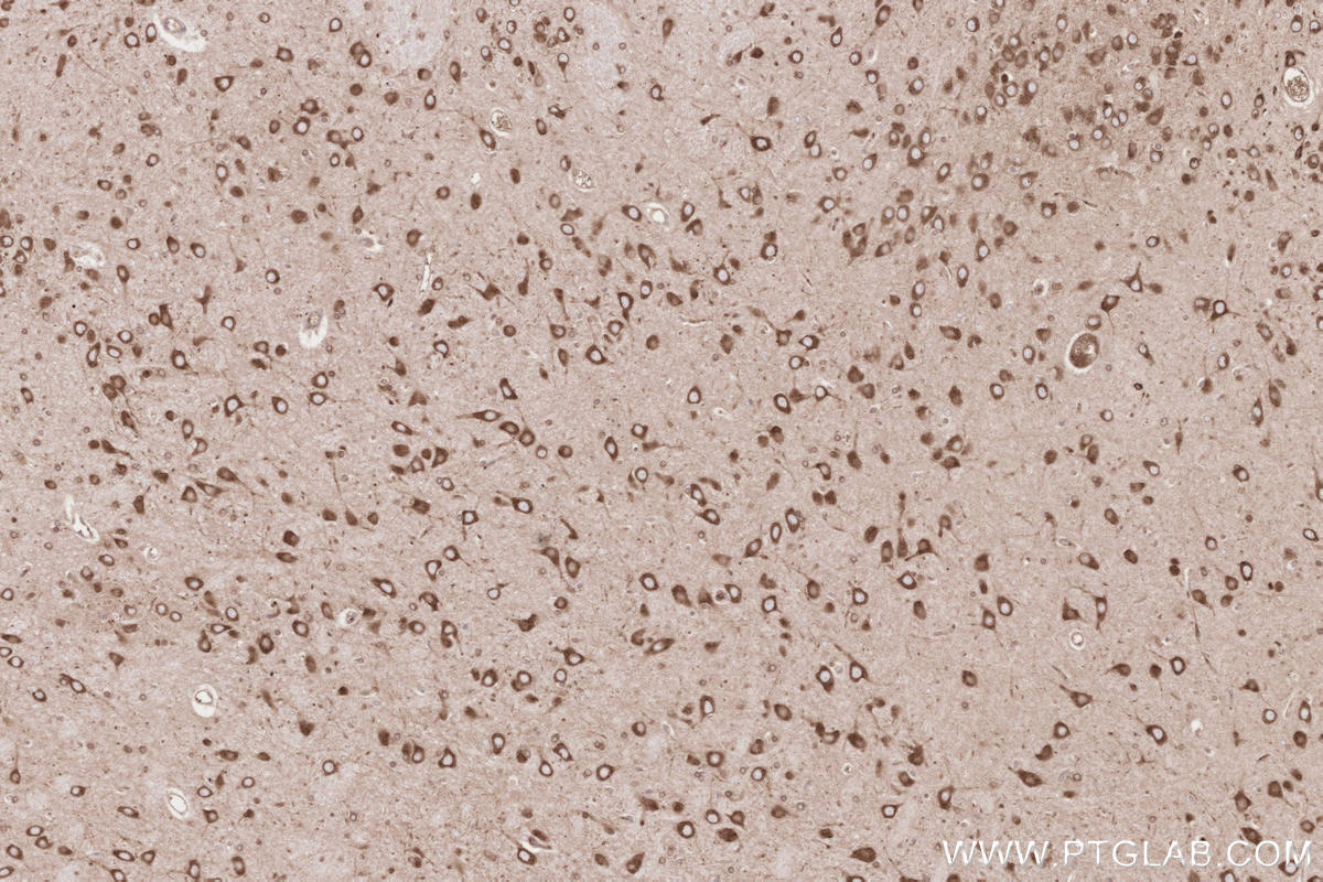 Immunohistochemical analysis of paraffin-embedded rat brain tissue slide using KHC2633 (SYVN1/HRD1 IHC Kit).