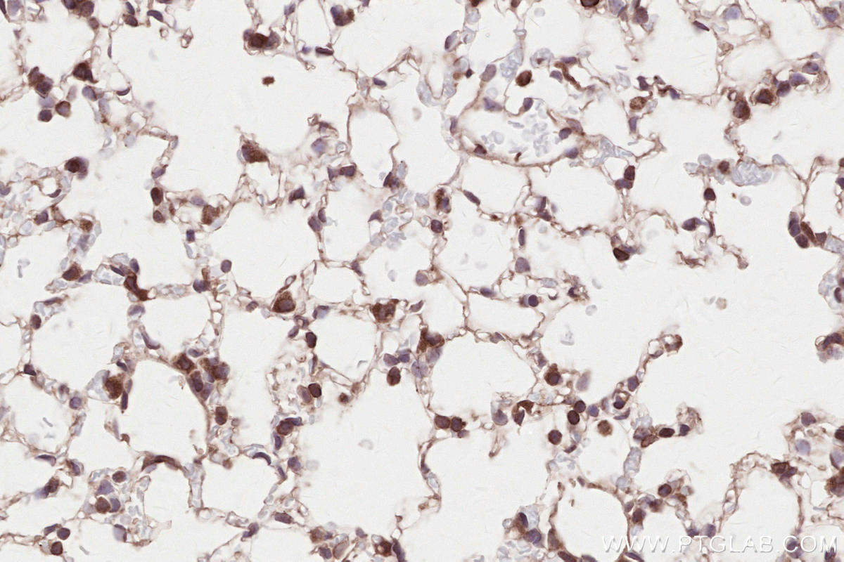 Immunohistochemical analysis of paraffin-embedded mouse lung tissue slide using KHC2633 (SYVN1/HRD1 IHC Kit).