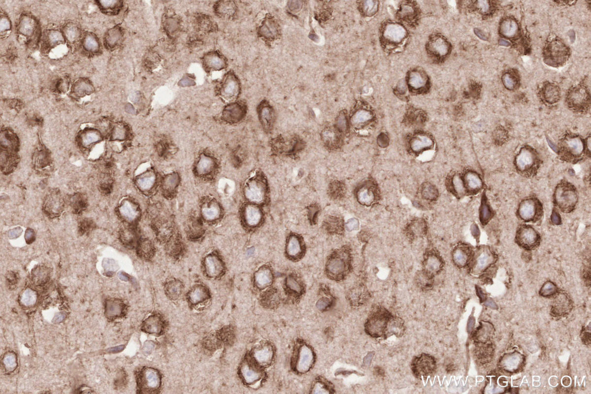 Immunohistochemical analysis of paraffin-embedded mouse brain tissue slide using KHC2633 (SYVN1/HRD1 IHC Kit).