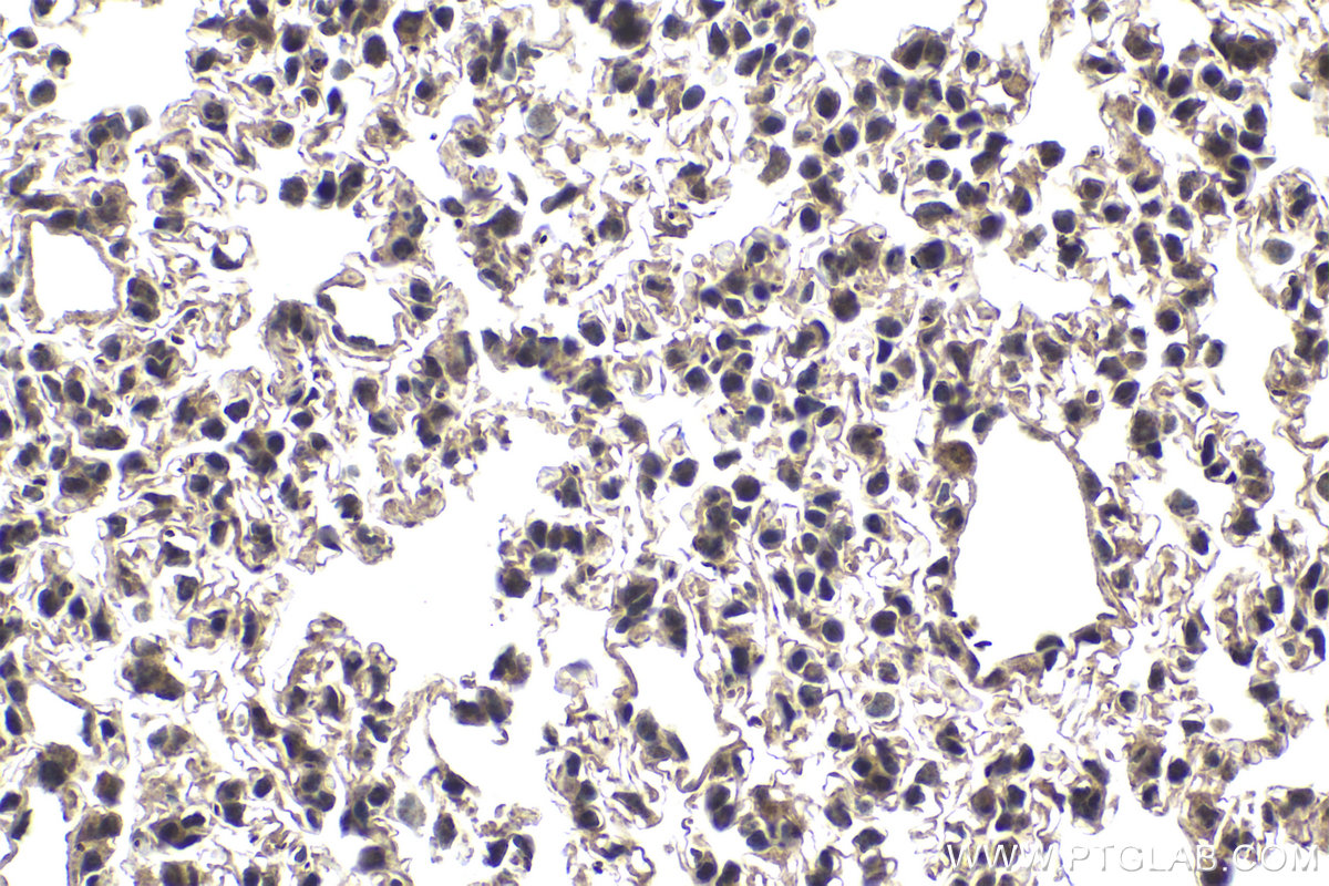 Immunohistochemical analysis of paraffin-embedded mouse lung tissue slide using KHC1754 (TAF7 IHC Kit).