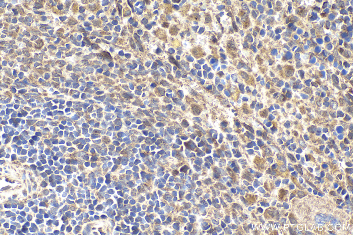 Immunohistochemical analysis of paraffin-embedded rat spleen tissue slide using KHC1939 (TASL/CXorf21 IHC Kit).