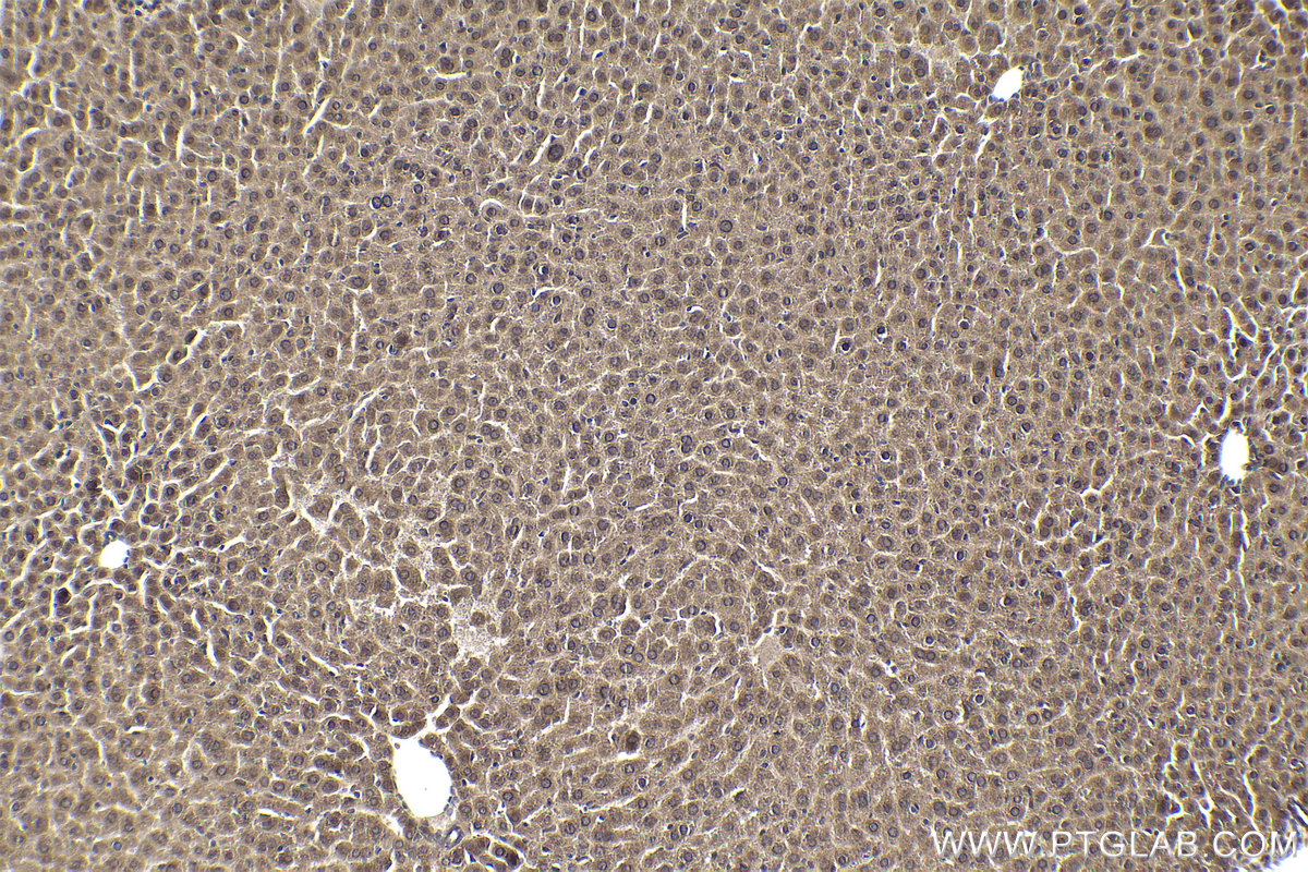 Immunohistochemical analysis of paraffin-embedded mouse liver tissue slide using KHC1936 (TDRD3 IHC Kit).