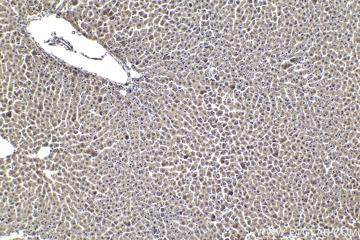 Immunohistochemical analysis of paraffin-embedded rat liver tissue slide using KHC1936 (TDRD3 IHC Kit).