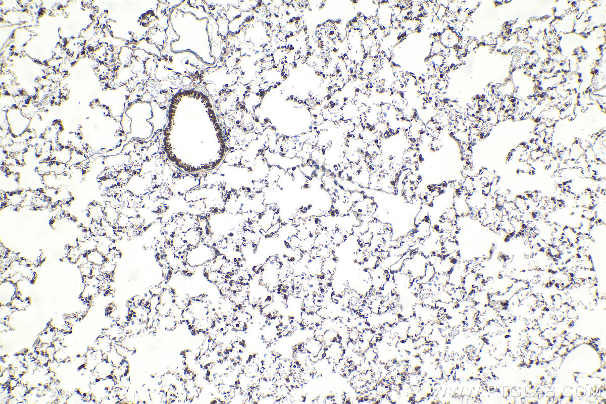 Immunohistochemical analysis of paraffin-embedded rat lung tissue slide using KHC1936 (TDRD3 IHC Kit).