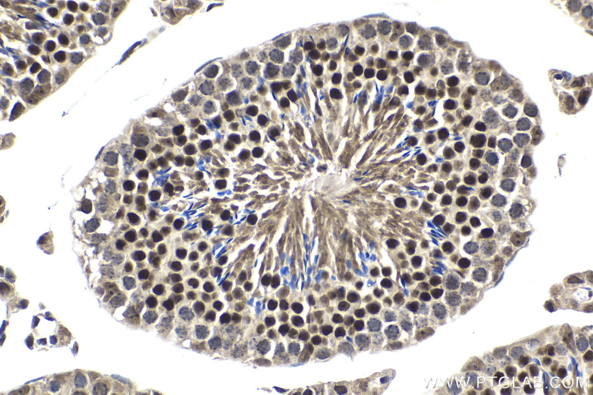Immunohistochemical analysis of paraffin-embedded mouse testis tissue slide using KHC1971 (TERF2IP IHC Kit).