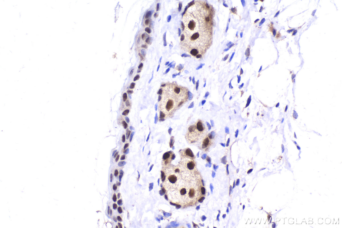 Immunohistochemical analysis of paraffin-embedded mouse skin tissue slide using KHC2162 (TFAP2A IHC Kit).