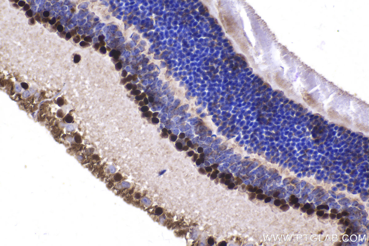 Immunohistochemical analysis of paraffin-embedded mouse eye tissue slide using KHC2162 (TFAP2A IHC Kit).