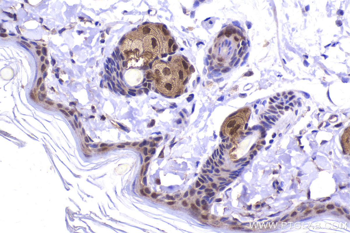 Immunohistochemical analysis of paraffin-embedded rat skin tissue slide using KHC2162 (TFAP2A IHC Kit).