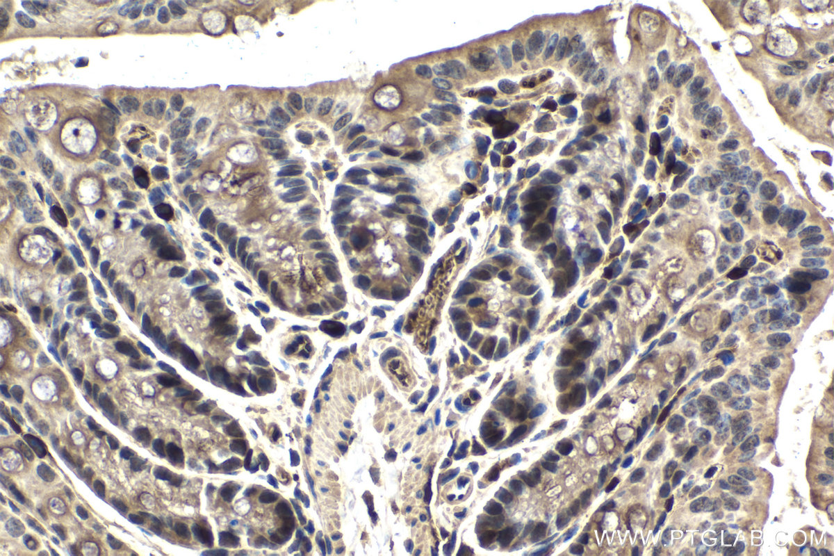 Immunohistochemical analysis of paraffin-embedded mouse colon tissue slide using KHC1547 (TFE3 IHC Kit).
