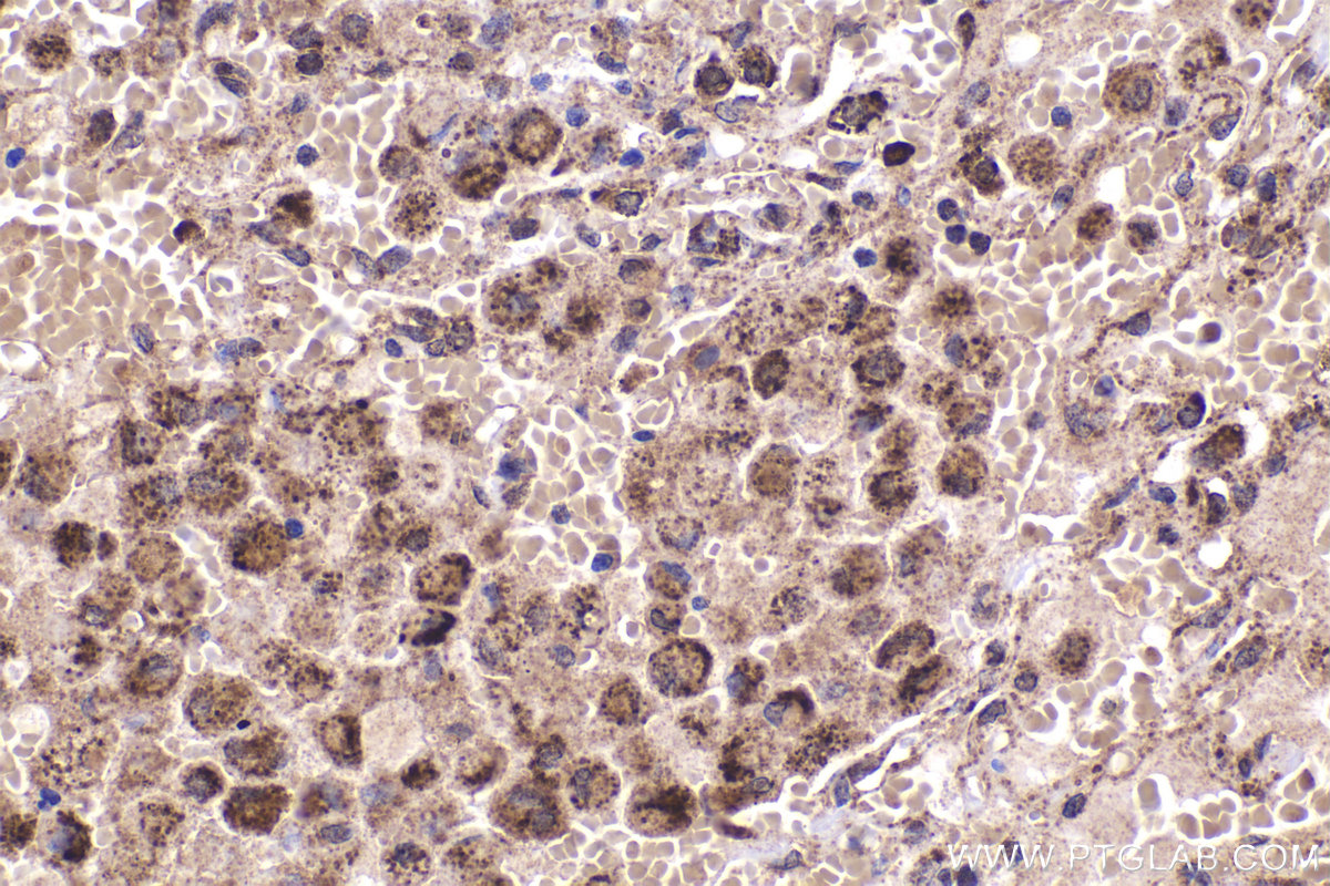 Immunohistochemical analysis of paraffin-embedded human lung tissue slide using KHC2342 (TGFB2 IHC Kit).