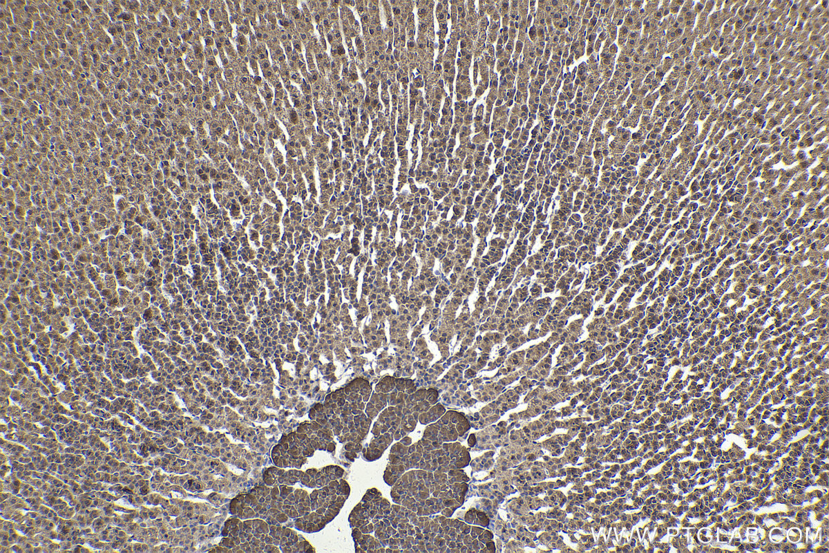 Immunohistochemical analysis of paraffin-embedded rat adrenal gland tissue slide using KHC2188 (TH IHC Kit).