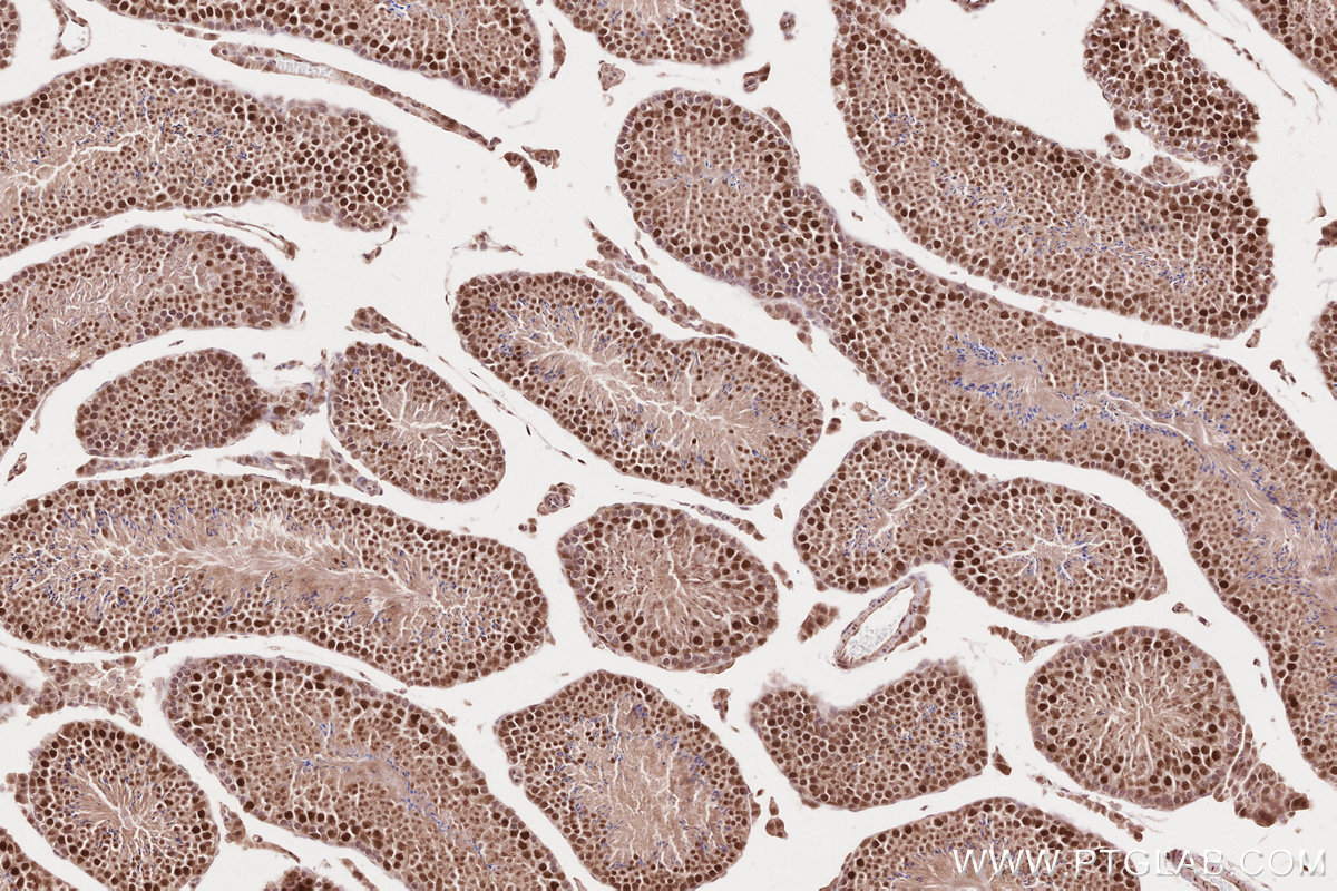 Immunohistochemical analysis of paraffin-embedded mouse testis tissue slide using KHC2634 (TLK2 IHC Kit).