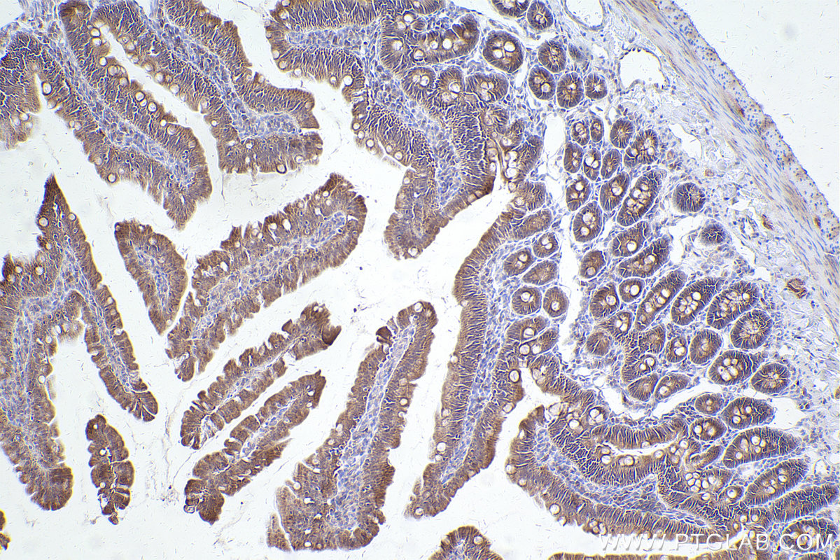 Immunohistochemical analysis of paraffin-embedded rat small intestine tissue slide using KHC2541 (TMEM41B IHC Kit).