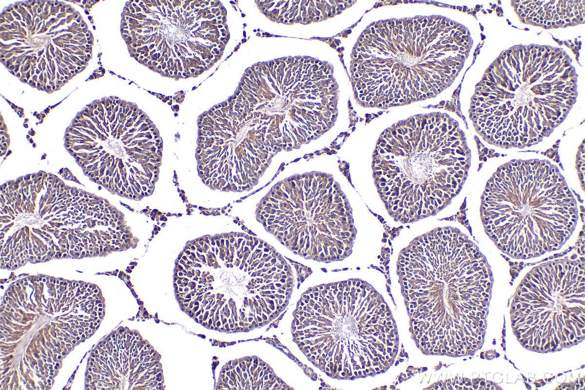 Immunohistochemical analysis of paraffin-embedded rat testis tissue slide using KHC2039 (TMEM8B/NGX6 IHC Kit).