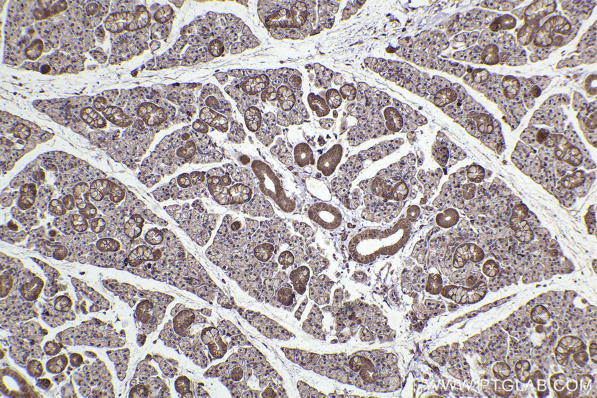 Immunohistochemical analysis of paraffin-embedded rat salivary gland tissue slide using KHC2443 (TNFAIP1 IHC Kit).