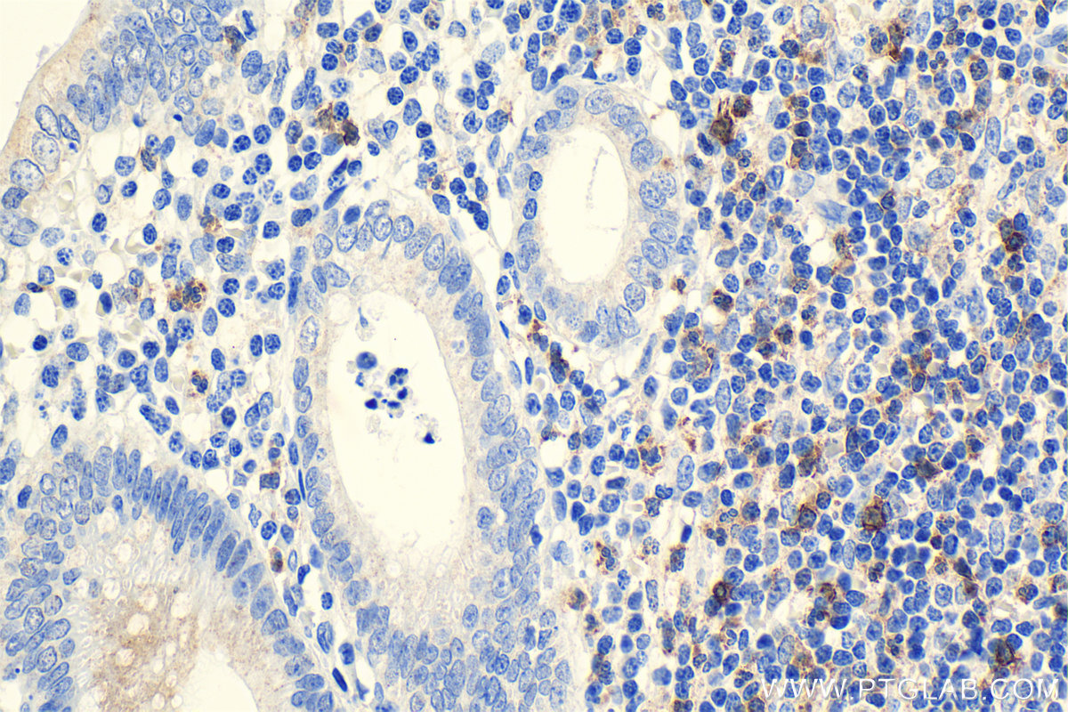 Immunohistochemical analysis of paraffin-embedded human appendicitis tissue slide using KHC1156 (TNFR2/TNFRSF1B IHC Kit).