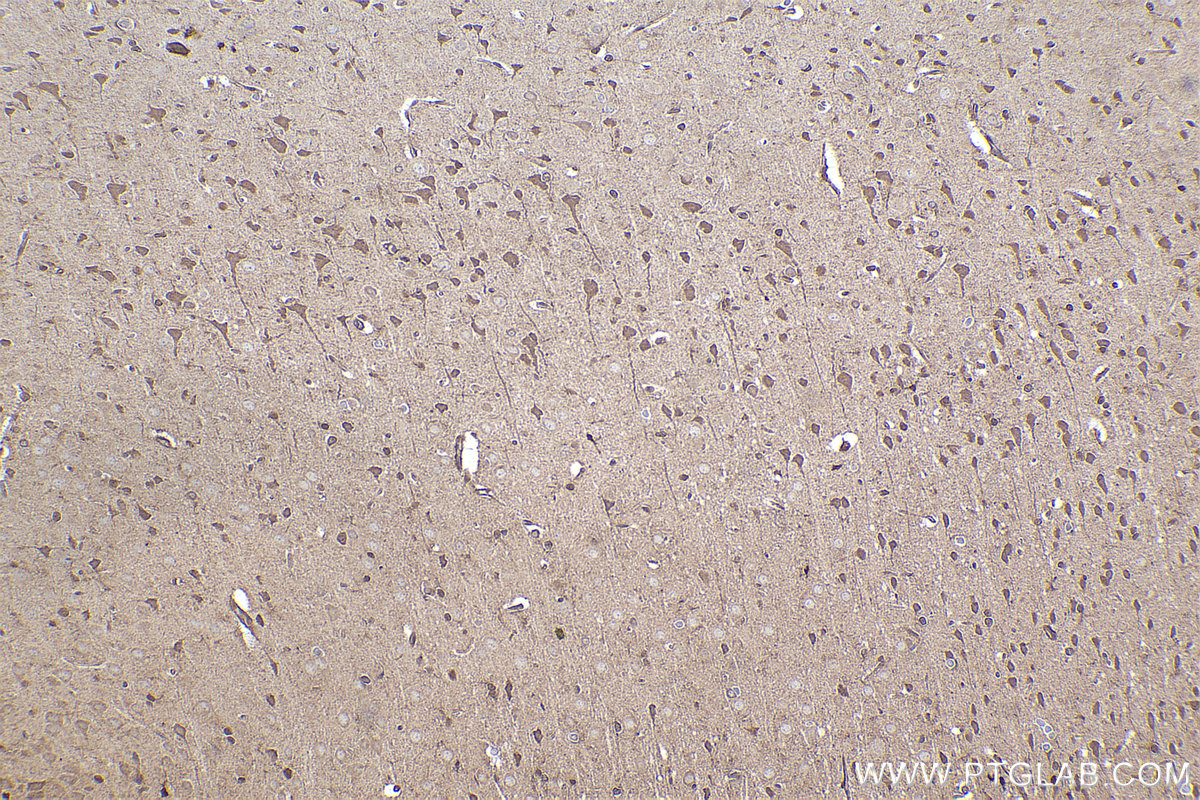 Immunohistochemical analysis of paraffin-embedded rat brain tissue slide using KHC2428 (TNK1 IHC Kit).