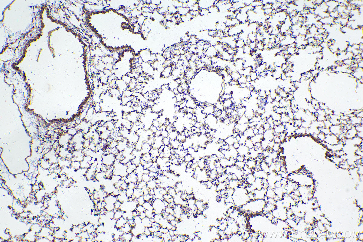 Immunohistochemical analysis of paraffin-embedded mouse lung tissue slide using KHC2428 (TNK1 IHC Kit).