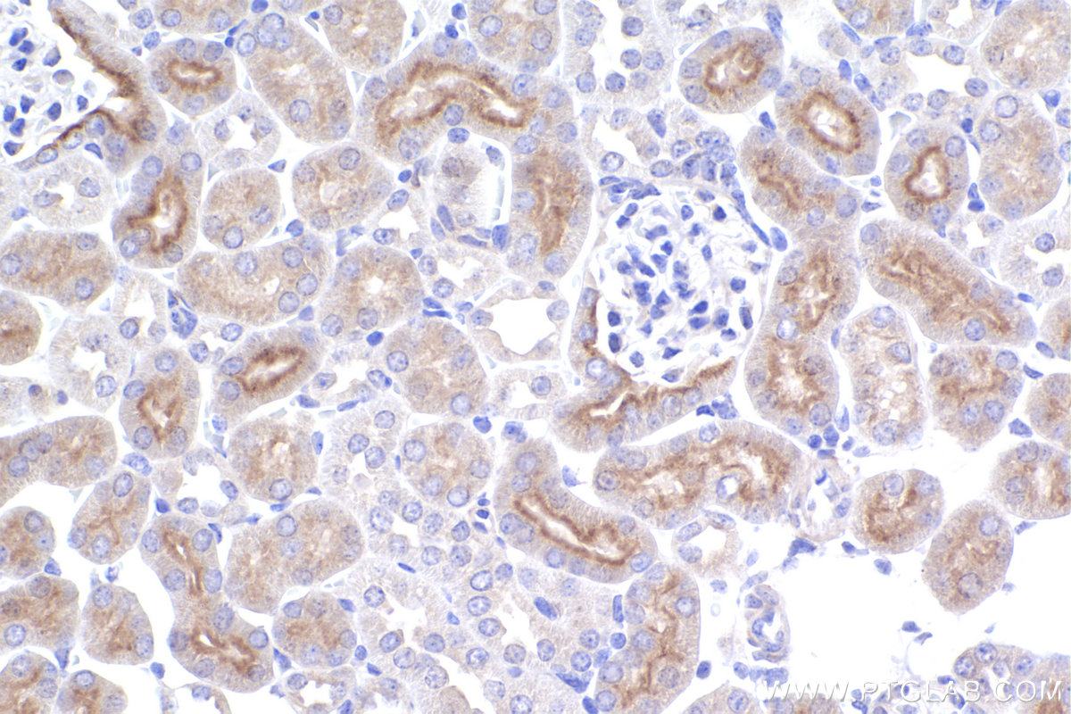 Immunohistochemical analysis of paraffin-embedded mouse kidney tissue slide using KHC2401 (TNK2/ACK1 IHC Kit).