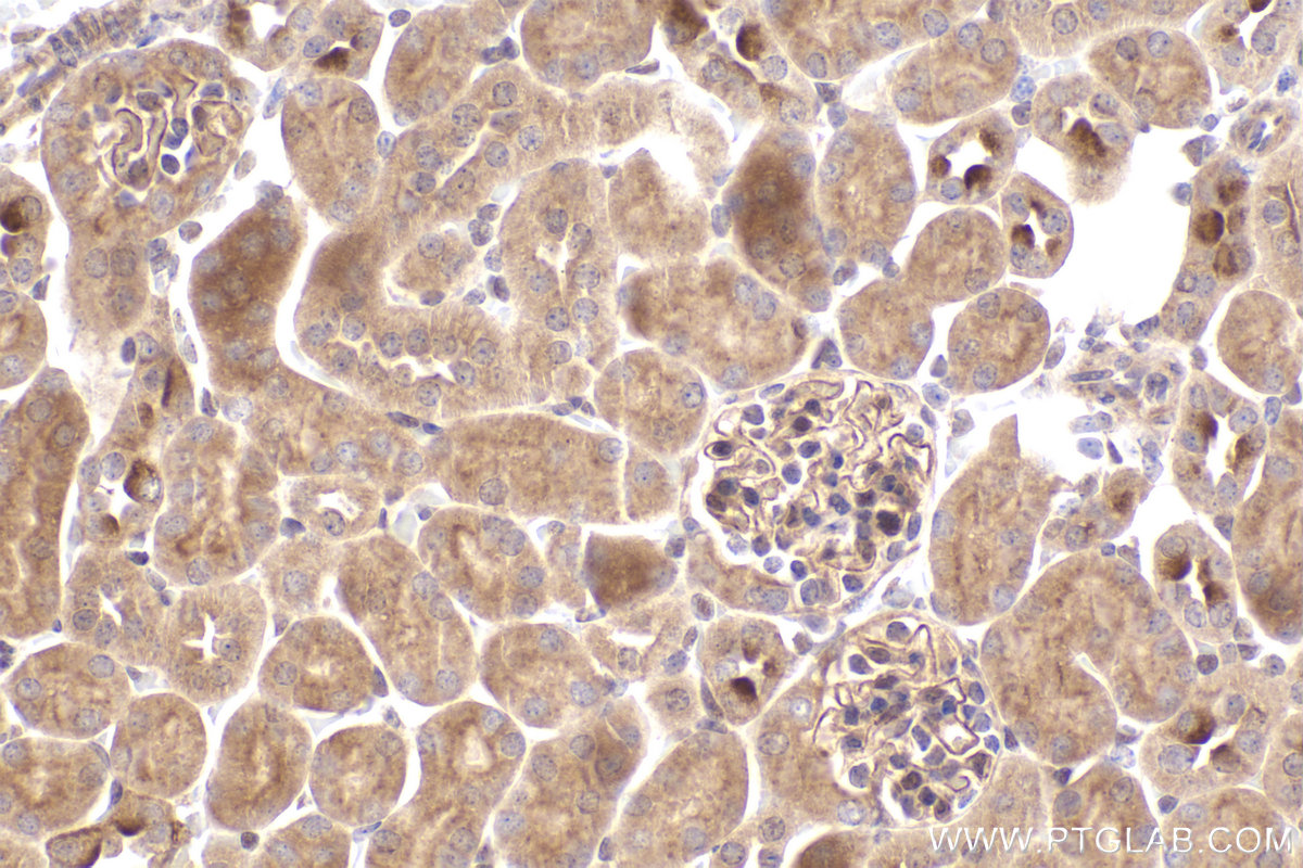 Immunohistochemical analysis of paraffin-embedded mouse kidney tissue slide using KHC2445 (TOB2 IHC Kit).