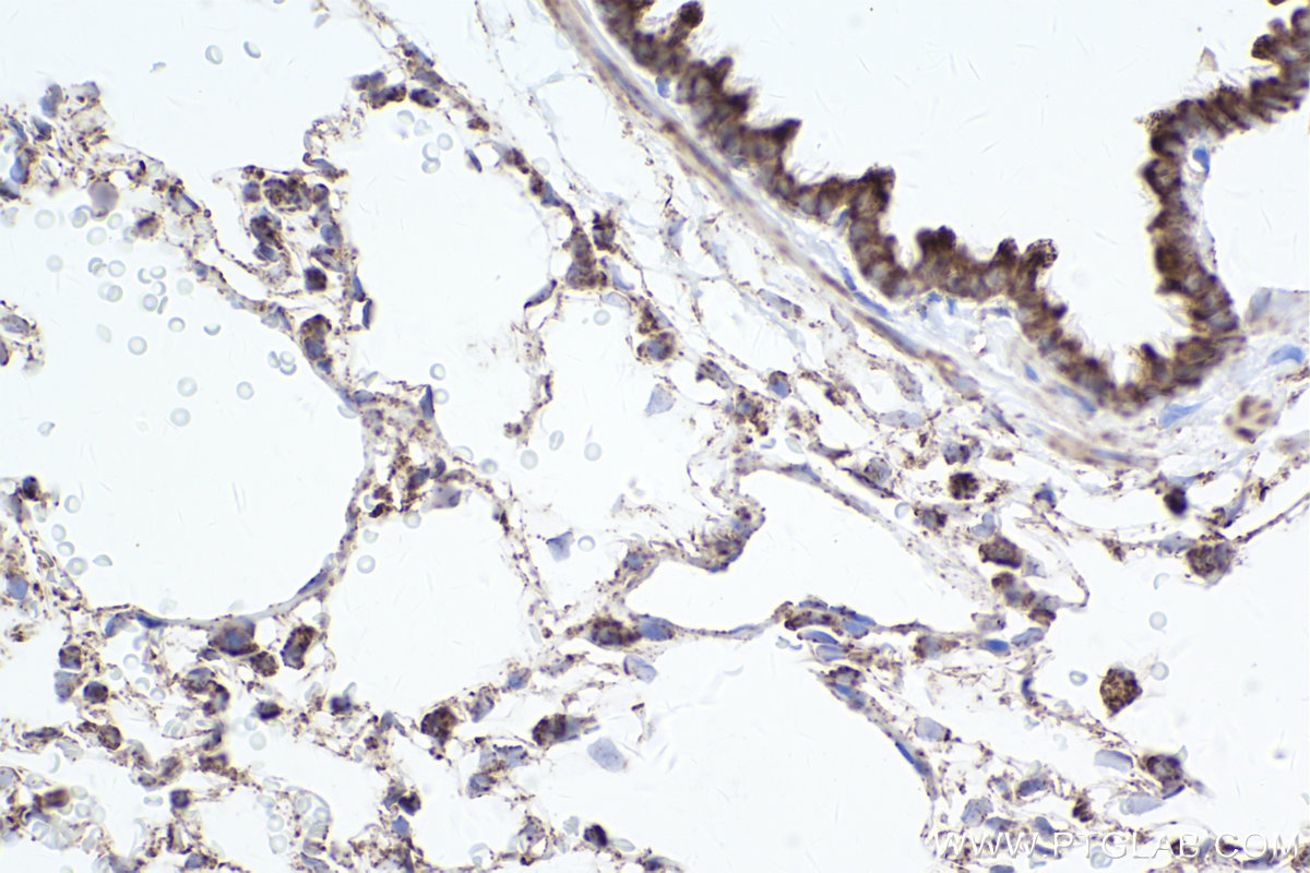 Immunohistochemical analysis of paraffin-embedded rat lung tissue slide using KHC2487 (TOMM20 IHC Kit).