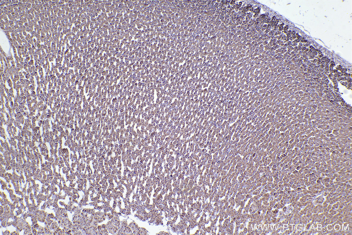 Immunohistochemical analysis of paraffin-embedded rat adrenal gland tissue slide using KHC2487 (TOMM20 IHC Kit).