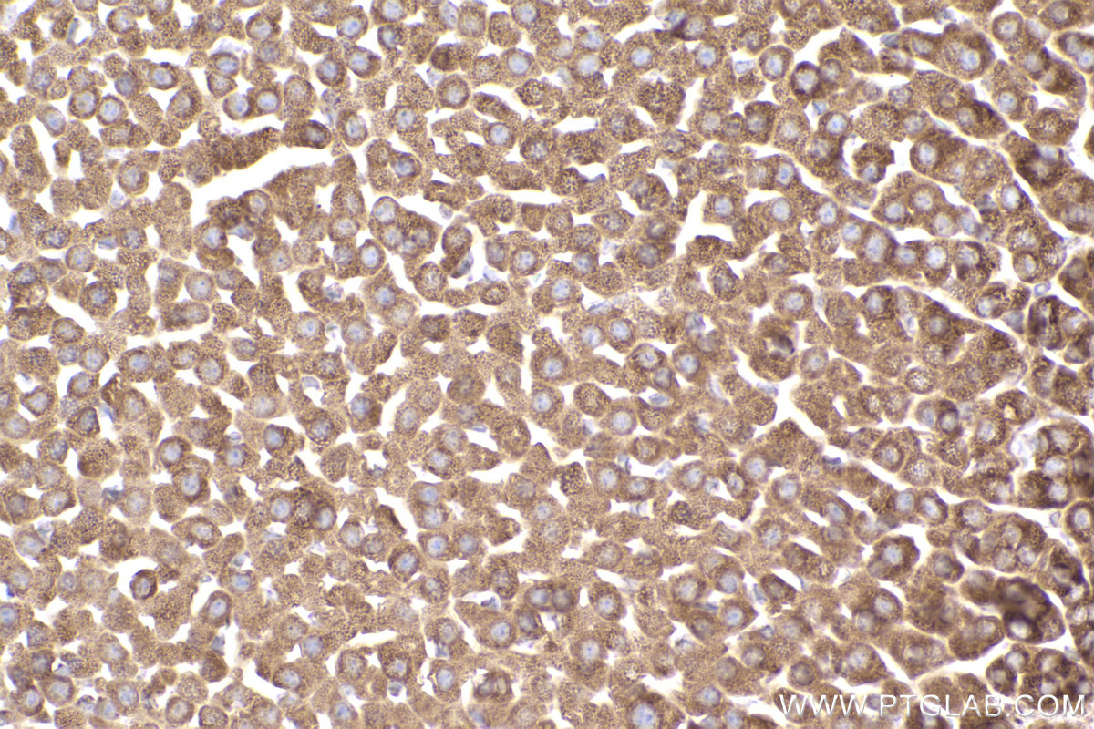 Immunohistochemical analysis of paraffin-embedded mouse adrenal gland tissue slide using KHC2487 (TOMM20 IHC Kit).