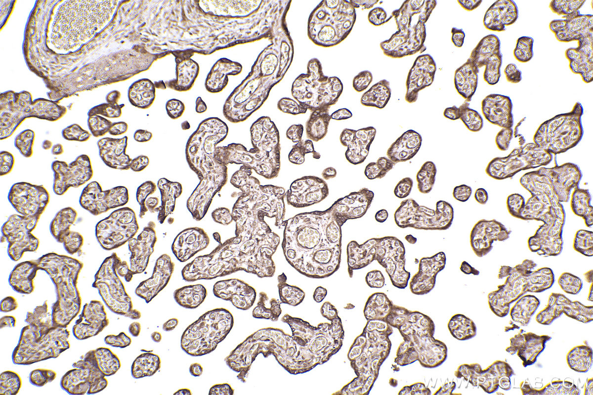 Immunohistochemical analysis of paraffin-embedded human placenta tissue slide using KHC2439 (TP53BP2 IHC Kit).