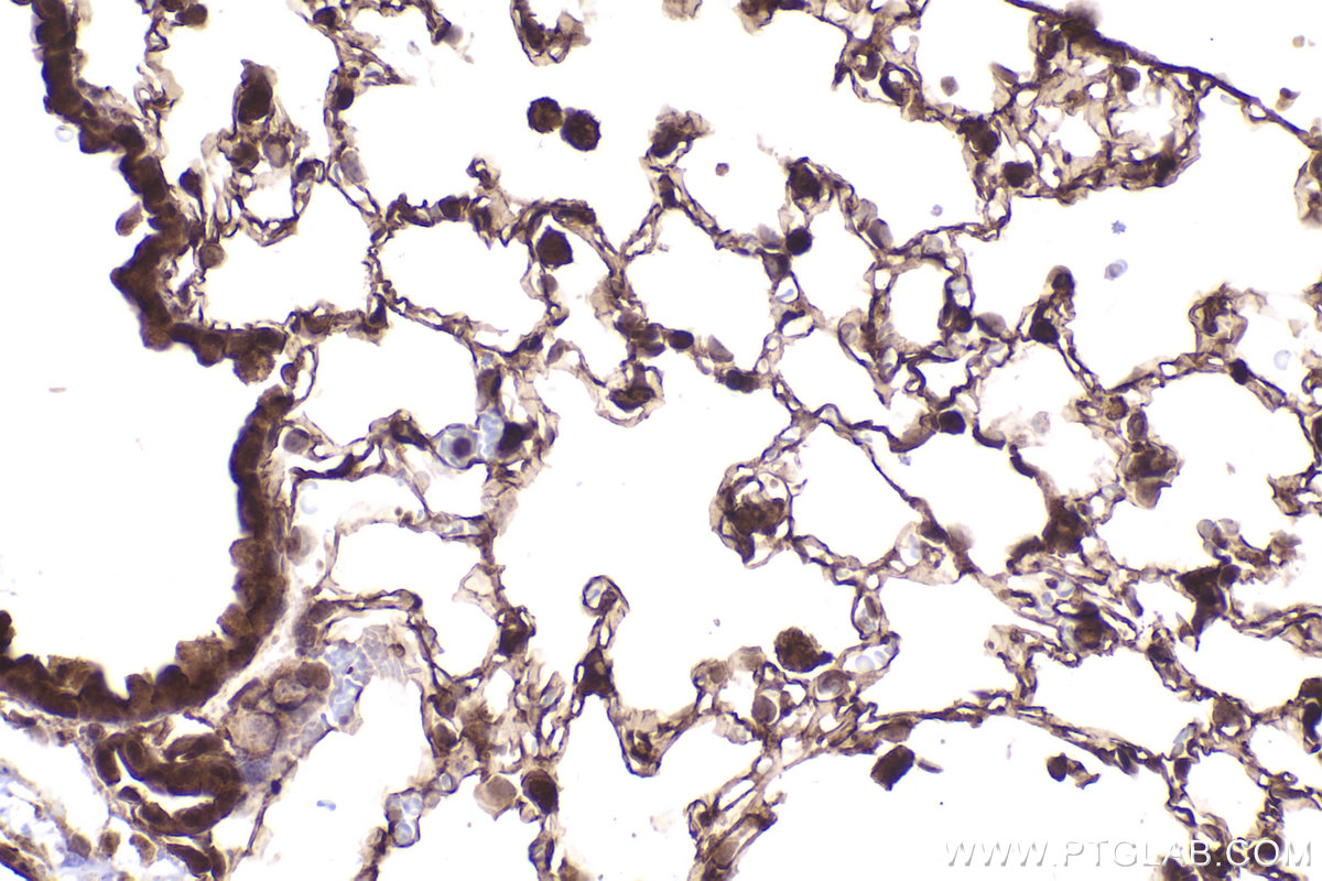 Immunohistochemical analysis of paraffin-embedded mouse lung tissue slide using KHC2439 (TP53BP2 IHC Kit).