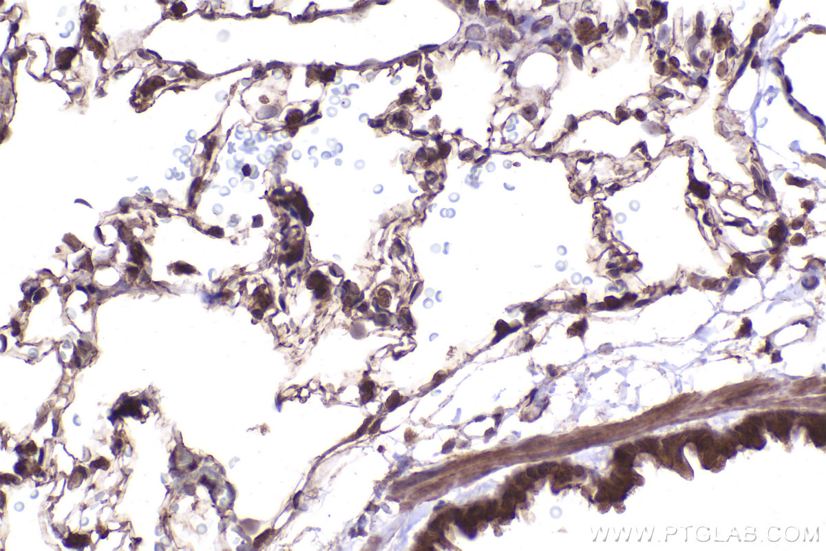 Immunohistochemical analysis of paraffin-embedded rat lung tissue slide using KHC2439 (TP53BP2 IHC Kit).